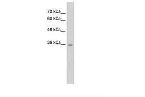 Chromosome 6 Open Reading Frame 134 (C6orf134) (N-Term) antibody