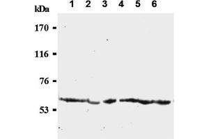 Western Blotting (WB) image for anti-Cell Division Cycle 25 Homolog C (S. Pombe) (CDC25C) antibody (ABIN487484)