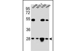 TF Antibody (C-term) (ABIN654229 and ABIN2844063) western blot analysis in Hela,Jurkat,K562,MCF-7 cell line lysates (35 μg/lane). (TFAM antibody  (C-Term))