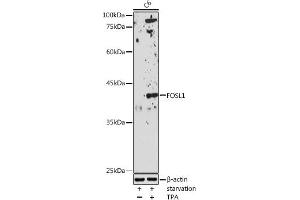 Western blot analysis of extracts of C6 cells, using FOSL1 antibody (ABIN6131653, ABIN6140738, ABIN6140739 and ABIN6221016) at 1:1000 dilution. (FOSL1 antibody  (AA 1-100))