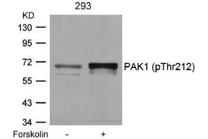 Western blot analysis of extracts from 293 cells untreated or treated with forskolin using PAK1(Phospho-Thr212) Antibody. (PAK1 antibody  (pThr212))