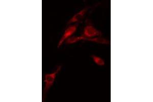 ABIN6274272 staining COLO205 cells by IF/ICC. (FXR2 antibody  (C-Term))