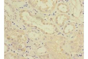 Immunohistochemistry of paraffin-embedded human kidney tissue using ABIN7153109 at dilution of 1:100 (FTCD antibody  (AA 412-541))