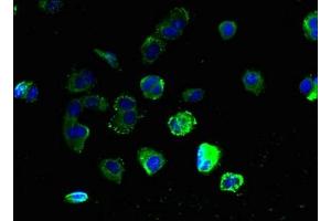 Immunofluorescent analysis of MCF-7 cells using ABIN7153339 at dilution of 1:100 and Alexa Fluor 488-congugated AffiniPure Goat Anti-Rabbit IgG(H+L) (GPR3 antibody  (AA 300-330))