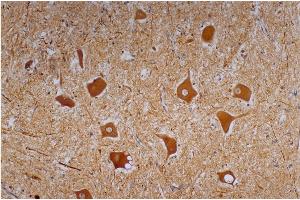 Immunohistochemistry staining of human cerebellum (paraffin-embedded sections) with anti-neurofilament heavy protein (NF-01). (NEFH antibody)