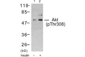 Western blot analysis using Akt (phospho-Thr308) antibody (E011055): Lane1: The extract from 293 cells untreated, Lane 2: The extract from 293 cells treated with insulin. (AKT1 antibody  (pThr308))