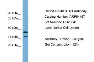 WB Suggested Anti-KCTD21  Antibody Titration: 0. (KCTD21 antibody  (Middle Region))