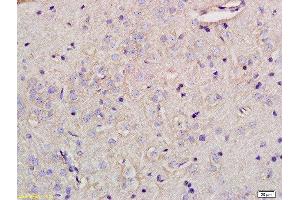 Formalin-fixed and paraffin embedded rat brain tissue labeled with Anti-Glypican 5 Polyclonal Antibody, Unconjugated at 1:200 followed by conjugation to the secondary antibody (GPC5 antibody  (AA 251-350))