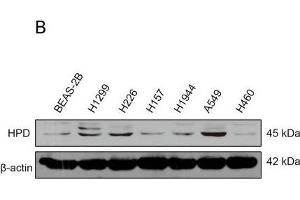 HPD expression is evaluated in lung cancer and is important for cancer cell proliferation and tumor growth. (HPD antibody)