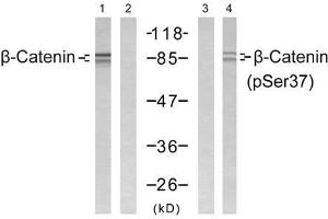 Western blot analysis of extract from SW 626 cells, using β-Catenin (Ab-37) antibody (E021212, Lane 1 and 2) and β-Catenin (phospho-Ser37) antibody (E011219, Lane 3 and 4). (beta Catenin antibody)