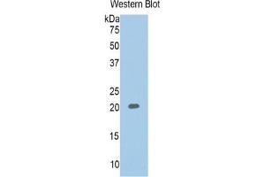 Western Blotting (WB) image for serpin Peptidase Inhibitor, Clade A (Alpha-1 Antiproteinase, Antitrypsin), Member 6 (SERPINA6) ELISA Kit (ABIN6574263)
