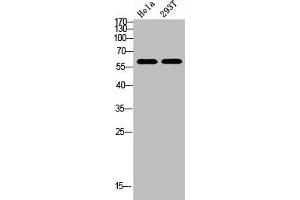 Western Blot analysis of HELA, 293t cells using Antibody diluted at 800. (c-Rel antibody  (AA 491-540))