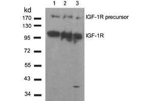 Image no. 2 for anti-Insulin-Like Growth Factor 1 Receptor (IGF1R) (Tyr1280) antibody (ABIN197576) (IGF1R antibody  (Tyr1280))