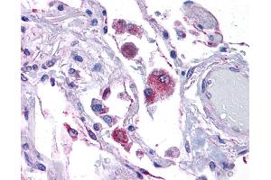 Immunohistochemistry (IHC) image for anti-KIT Ligand (KITLG) (Middle Region) antibody (ABIN2781827) (KIT Ligand antibody  (Middle Region))