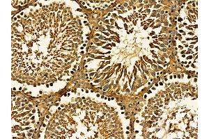 ABIN7095660 and ABIN7099722 at 1/100 staining rat testis tissue by IHC-P.