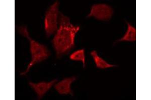 ABIN6266459 staining Hela by IF/ICC. (FER antibody  (pTyr402))