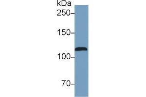 Detection of NOS2 in Human Serum using Monoclonal Antibody to Nitric Oxide Synthase 2, Inducible (NOS2) (NOS2 antibody  (AA 734-966))