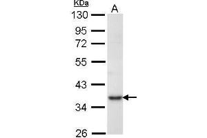 WB Image Sample (30 ug of whole cell lysate) A: Molt-4 , 10% SDS PAGE antibody diluted at 1:1000 (PRPS1 antibody)