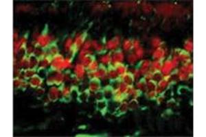 Immunofluorescence (IF) image for anti-DNA (Cytosine-5-)-Methyltransferase 3 alpha (DNMT3A) (C-Term) antibody (ABIN6657590)