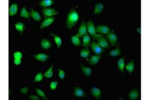 Immunofluorescent analysis of A549 cells using ABIN7170853 at dilution of 1:100 and Alexa Fluor 488-congugated AffiniPure Goat Anti-Rabbit IgG(H+L) (MMP11 antibody  (AA 198-377))