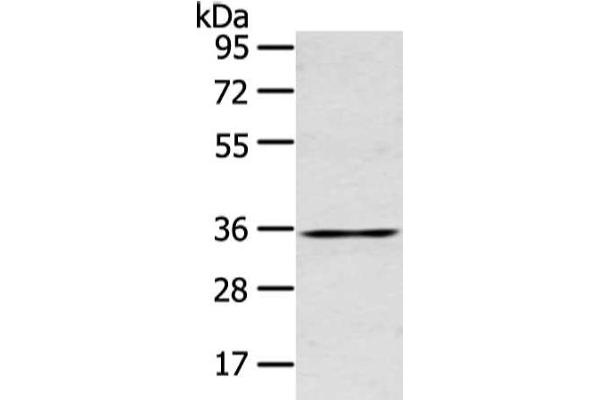 GJB5 antibody