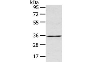 Gel: 10 % SDS-PAGE, Lysate: 40 μg, Lane: Human placenta tissue, Primary antibody: ABIN7190810(GJB5 Antibody) at dilution 1/400 dilution, Secondary antibody: Goat anti rabbit IgG at 1/8000 dilution, Exposure time: 15 seconds