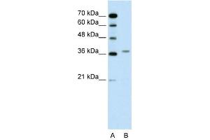 WB Suggested Anti-ALAD  Antibody Titration: 0. (ALAD antibody  (N-Term))