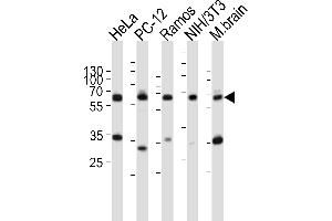 Pyruvate Kinase anticorps  (C-Term)
