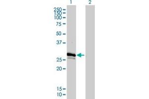 Western Blotting (WB) image for anti-Gap Junction Protein, beta 3, 31kDa (GJB3) (AA 1-270) antibody (ABIN561044)