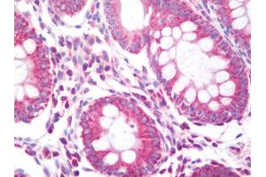 Immunohistochemistry (IHC) image for anti-Carbamoyl-Phosphate Synthetase 2, Aspartate Transcarbamylase, and Dihydroorotase (CAD) (AA 1650-1700) antibody (ABIN2617833)