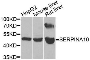 Western blot analysis of extracts of various cell lines, using SERPINA10 antibody. (SERPINA10 antibody  (AA 165-444))