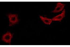 Immunofluorescence (fixed cells) (IF/ICC) image for anti-Insulin Receptor Substrate 1 (IRS1) (pSer307) antibody (ABIN6255185)