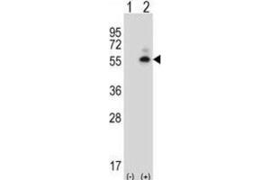 Western Blotting (WB) image for anti-Calcium/calmodulin-Dependent Protein Kinase II delta (CAMK2D) antibody (ABIN5017149)