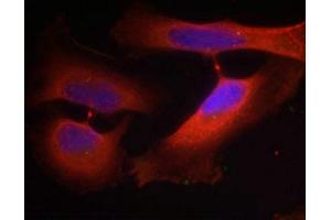 Immunofluorescence staining of methanol-fixed Hela cells using Keratin 8(Phospho-Ser74) Antibody. (KRT8 antibody  (pSer74))
