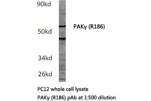Western blot (WB) analysis of PAKγ antibody in extracts from PC12 cells. (PAK2 antibody)