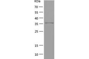 Poly (ADP-Ribose) Polymerase Family, Member 4 (PARP4) (AA 220-574) protein (His-IF2DI Tag)