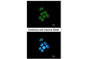 ICC/IF Image Immunofluorescence analysis of paraformaldehyde-fixed A431, using hnRNP K, antibody at 1:200 dilution. (HNRNPK antibody)