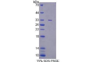 Image no. 1 for Cancer Susceptibility Candidate 5 (CASC5) (AA 1-230) protein (His tag) (ABIN6239692) (CASC5 Protein (AA 1-230) (His tag))