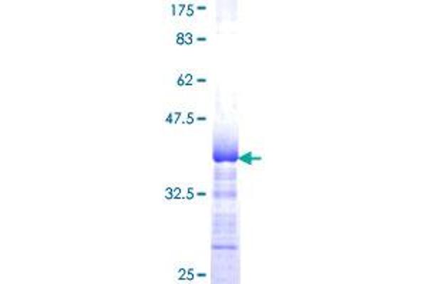EIF3S1 Protein (AA 157-258) (GST tag)