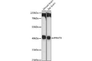 Western blot analysis of extracts of various cell lines, using PRMT8 antibody (ABIN1682310, ABIN3015998 and ABIN3015999) at 1:1000 dilution.