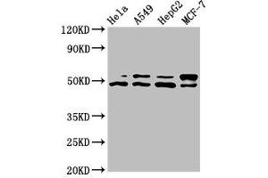 Western Blot Positive WB detected in: Hela whole cell lysate, A549 whole cell lysate, HepG2 whole cell lysate, MCF-7 whole cell lysate All lanes: AKT1 antibody at 7. (AKT1 antibody  (AA 1-480))