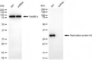 Western blotting analysis using replication protein A2 antibody (ABIN7800173).