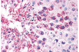 Human Testis (formalin-fixed, paraffin-embedded) stained with TFF2 antibody ABIN351426 at 15 ug/ml followed by biotinylated goat anti-rabbit IgG secondary antibody ABIN481713, alkaline phosphatase-streptavidin and chromogen. (Trefoil Factor 2 antibody  (Internal Region))