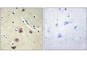 Immunohistochemistry analysis of paraffin-embedded human brain tissue, using AK5 Antibody. (Adenylate Kinase 5 antibody  (AA 391-440))