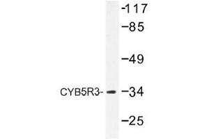Image no. 2 for anti-Cytochrome B5 Reductase 3 (CYB5R3) antibody (ABIN317921) (CYB5R3 antibody)