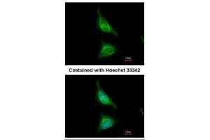 ICC/IF Image Immunofluorescence analysis of methanol-fixed HeLa, using Aladin, antibody at 1:500 dilution. (Adracalin antibody  (Internal Region))