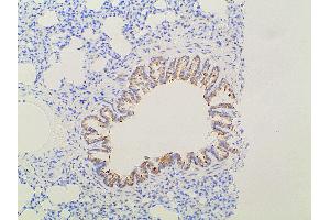 Immunohistochemistry (IHC) image for anti-Ephrin B2 (EFNB2) (C-Term) antibody (ABIN6261455)