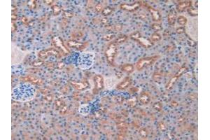 IHC-P analysis of Mouse Kidney Tissue, with DAB staining. (Resistin antibody  (AA 21-114))