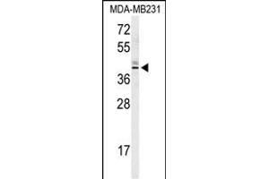 Western blot analysis of KLDC2 Antibody (C-term) (ABIN651014 and ABIN2840038) in MDA-M cell line lysates (35 μg/lane). (KLHDC2 antibody  (C-Term))