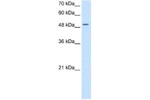 EIF2S3 antibody used at 5 ug/ml to detect target protein. (EIF2S3 antibody  (N-Term))